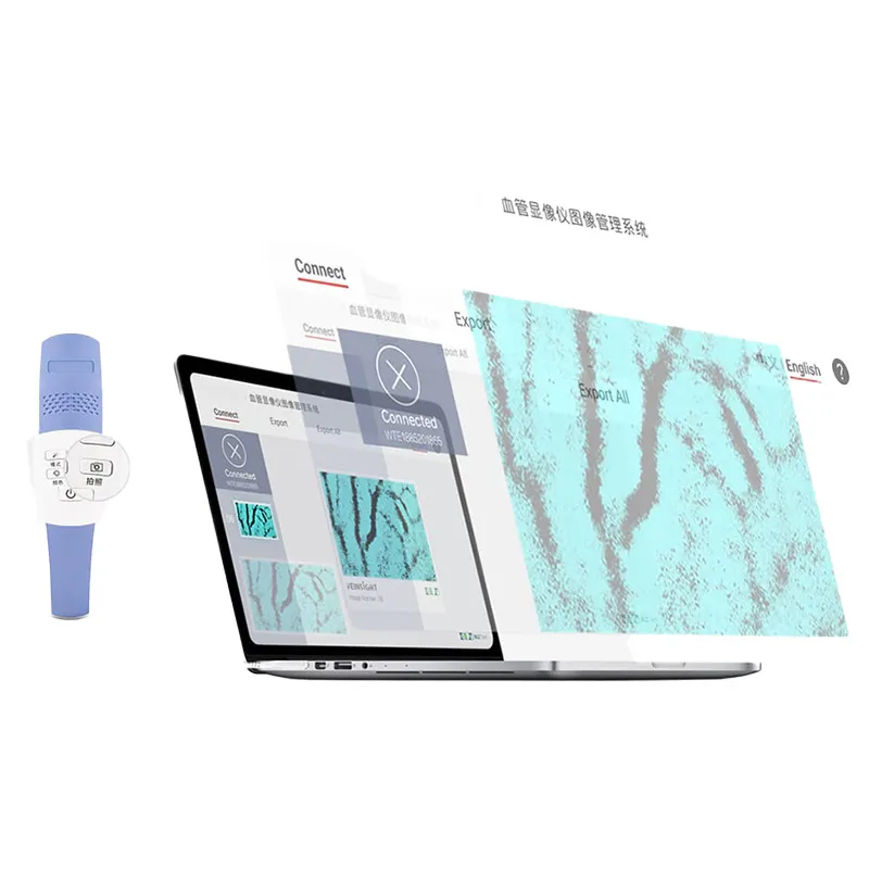 VS500 Medical Vein Finder Device